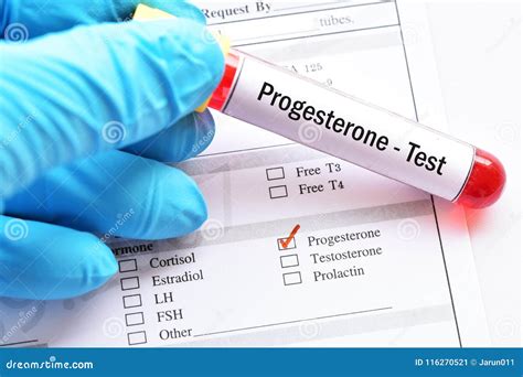 Progesterone hormone test stock image. Image of medicine - 116270521