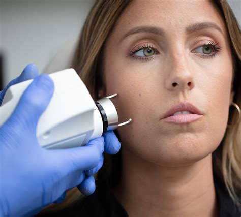 Laser Treatments Sistine Facial Plastic Surgery