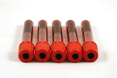 Blood Test Test Tube Laboratory Isolated Vector Test Tube Laboratory