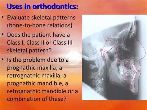 Extra Oral Radiology Techniques I Ppt