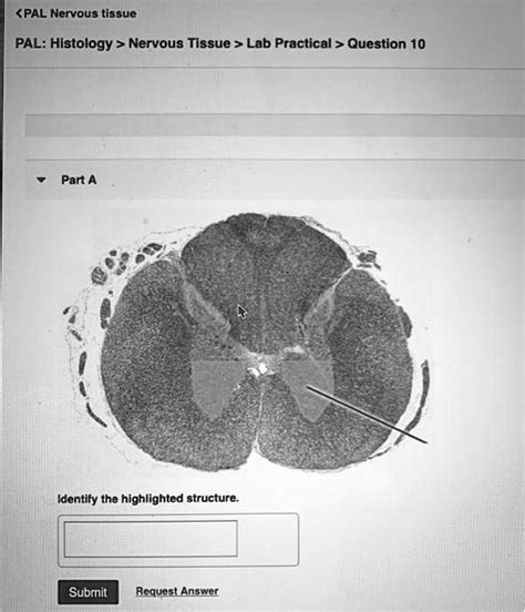 Solved Nervous Tissue Lab Practical Question Parta Identify The