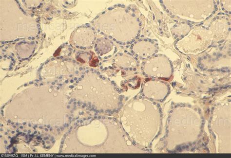 STOCK IMAGE Photomicrograph Of The Normal Thyroid Gland Histological