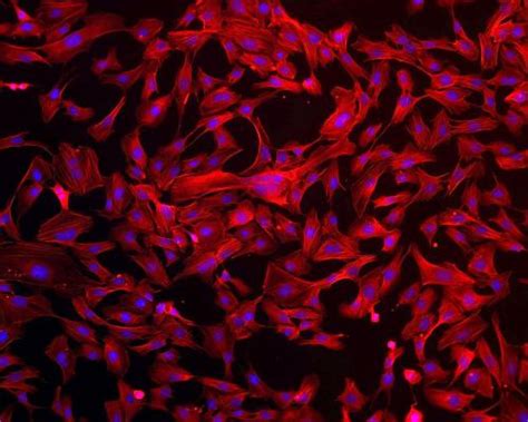 Image: Human endothelial cells experiment bound for ISS