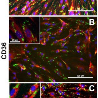 LipidTOX Green Neutral Lipid Stain Of HSKP HPC Cells Exposed To NA VPA