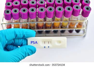 Blood Sample Psa Prostatespecific Antigen Positive Stock Photo