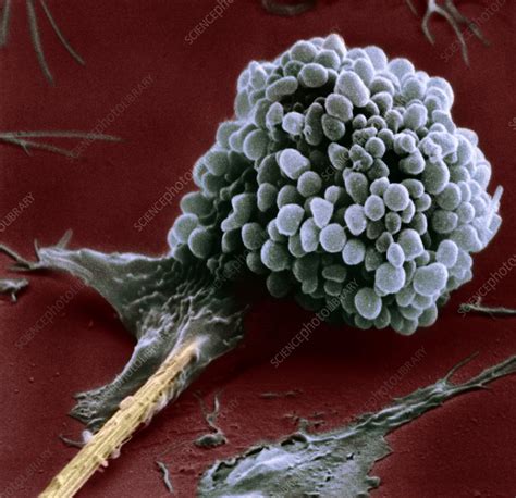 Macrophage Engulfing Dust Particles SEM Stock Image C051 8275