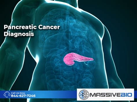 Pancreatic Cancer Diagnosis - Symptoms of Pancreatic Cancer