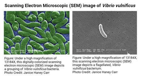 Vibrio Vulnificus