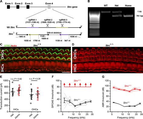 Dual Vector Gene Therapy Restores Cochlear Amplification And Auditory