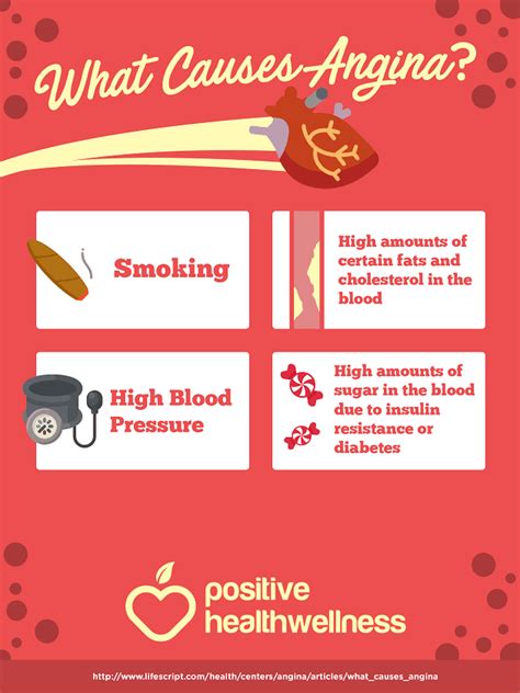 What Causes Angina Infographic Positive Health Wellness