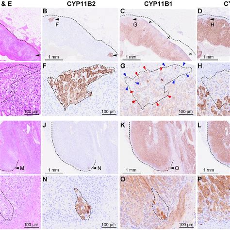 Histochemical And Immunohistochemical Staining For Samples 1 And 2