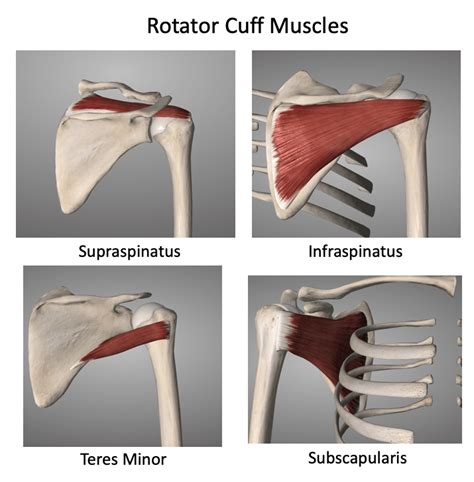 Navigating Shoulder Struggles Rotator Cuff Tear Vs Rotator Cuff