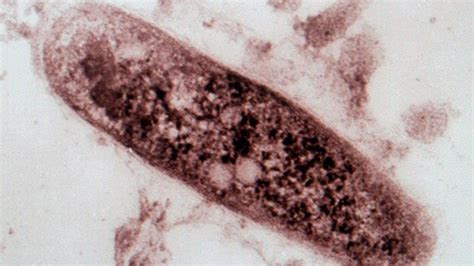 New Tuberculosis Vaccine Possible In Five Years As Researchers Say ...