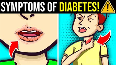 12 Unusual Symptoms Of Diabetes No One Is Telling You About Youtube