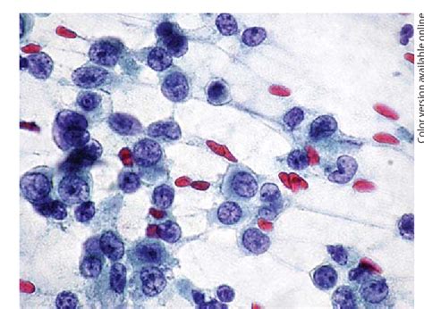 Cytologic Immunocytologic Histopathologic And Immunohistologic