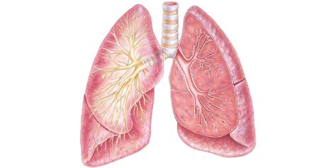 Rare Bone Formation In Lungs Discovered In Vascular Ehlers Danlos