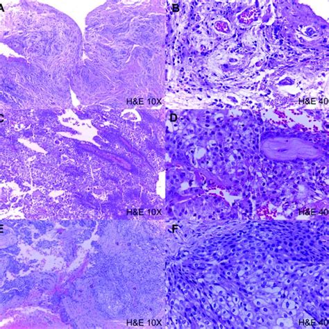 Histopathological Photomicrographs Whit Hematoxylin And Eosin Of