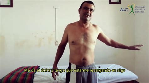 QUIROPRACTICO ESPONDILOLISTESIS IDOLOR DE ESPALDA EXTREMO YouTube