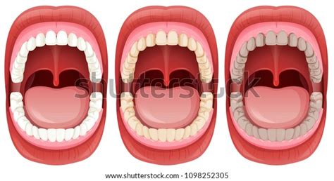 Set Human Mouth Anatomy Illustration Stock Vector (Royalty Free ...