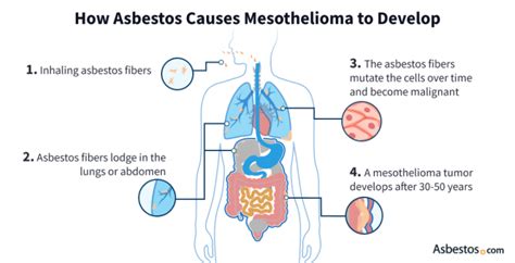 Mesothelioma Causes Asbestos Exposure Risks And Prevention