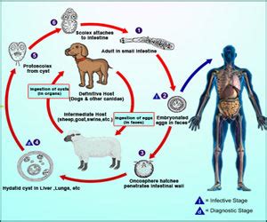 Hydatid Cyst Hydatid Disease Causes Symptoms Diagnosis Treatment