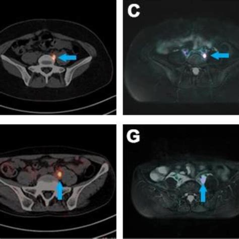 A Tumor Uptake SUVmax Of ROI In Micro PET And Tumor Meat Ratio Of