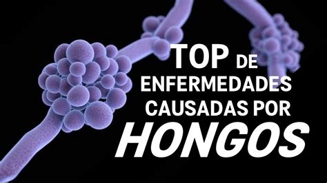 Top Enfermedades Causadas Por Hongos Youtube