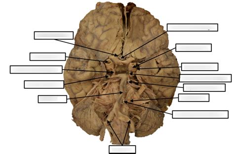 Cadaver Gross Brain Arterial Supply Diagram Quizlet