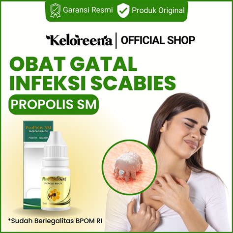 Jual Obat Sekabies Oles Scabies Manusia Skabies Tetes Gatal Budug Borok