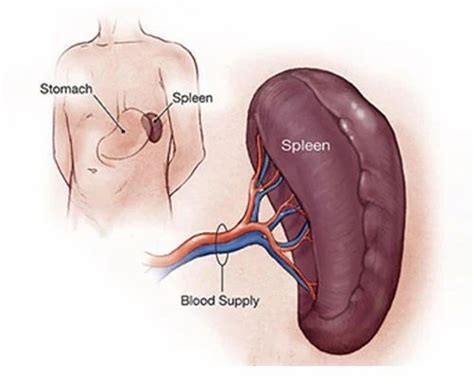 Laparoscopic Splenectomy Surgery In Faridabad Id 19944967173