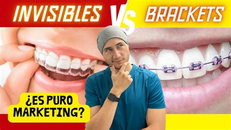 Brackets Vs Invisibles La Verdad YouTube