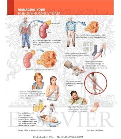 Managing Your Pheochromocytoma