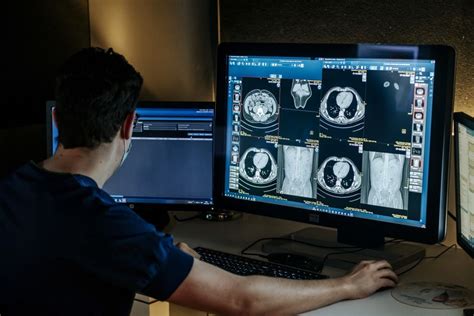 Fellowship Dr Mebis In De Sint Maartenkliniek In Nijmegen Radiologie