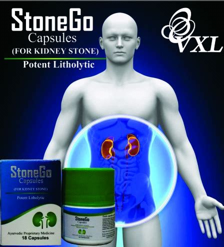 Herbal Medicine Stonego Capsules For Kidney Stone at Best Price in ...