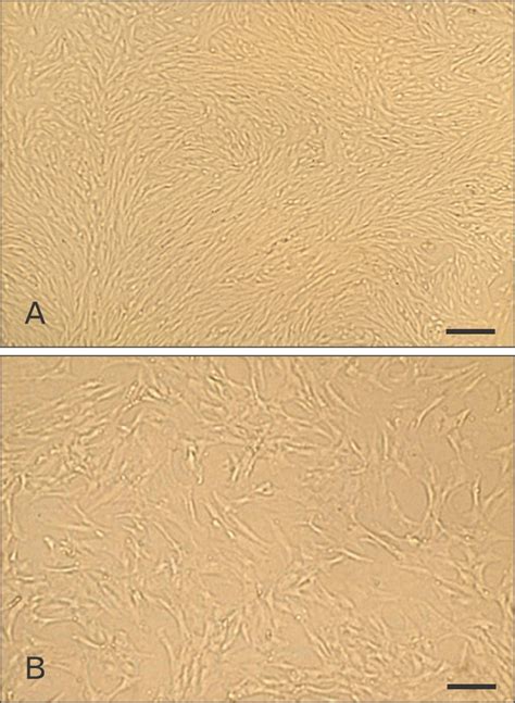 A B Cultured Rat Bone Marrow Mesenchymal Stem Cells At P3 Were Download Scientific Diagram