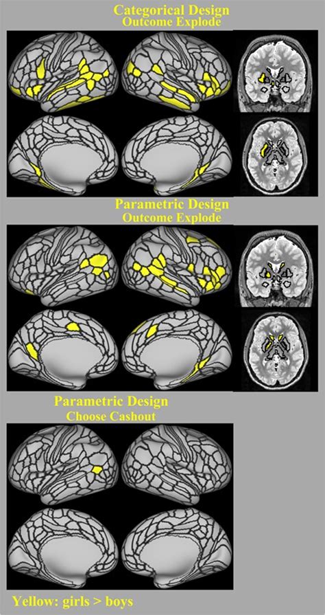 Adolescent Decision Making Under Risk Neural Correlates And Sex Differences Pmc