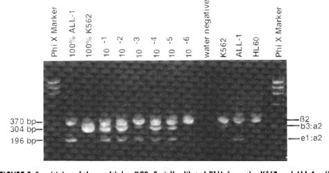 Figure From Multiplex Pcr Of Bcr Abl Fusion Transcripts In