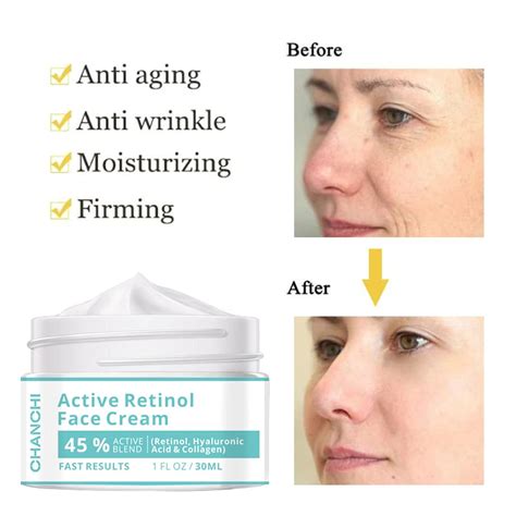 CHANCHI Crema Facial De Retinol Activa Mezcla Activa Del 45 Hidrata E