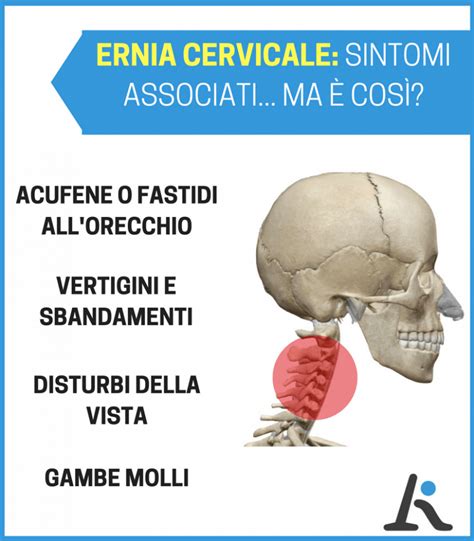 Ernie Cervicali Sintomi Vertigini