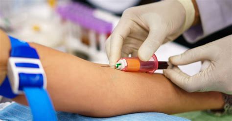 What To Expect During A Blood Test South Florida Healthcare Blog