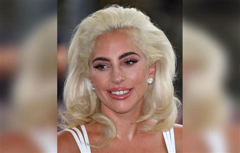 Lady Gaga S Plastic Surgery Makeover Exposed By Top Docs