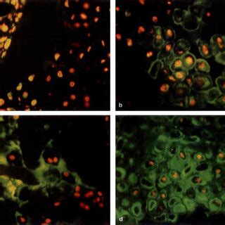 Immunohistochemistry Of Proteoglycan And Type Collagen Emf