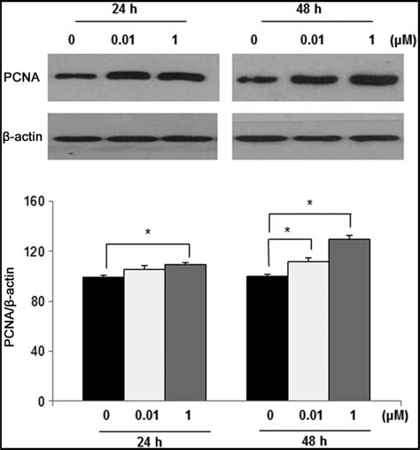 Analysis Of The In Vitro Effects Of Di 2ethylhexyl Phthalate