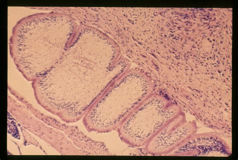 Spirometra Mansonoides Experimental Sparganum Infection In A Rat A