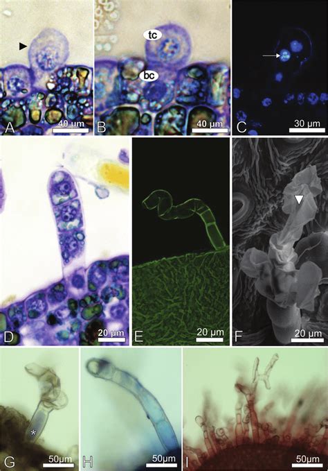 Myrsine Coriacea Multicellular Branched Trichomes Ontogeny And