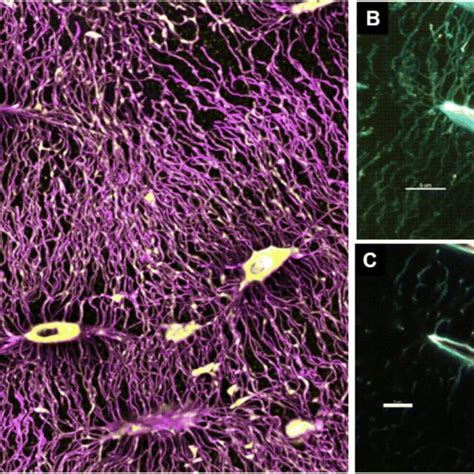 Osteocyte Remodeling Of The Lacunar Canalicular System Whats In A