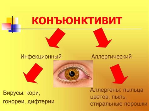 Профилактика конъюнктивита у детей и взрослых: основные правила
