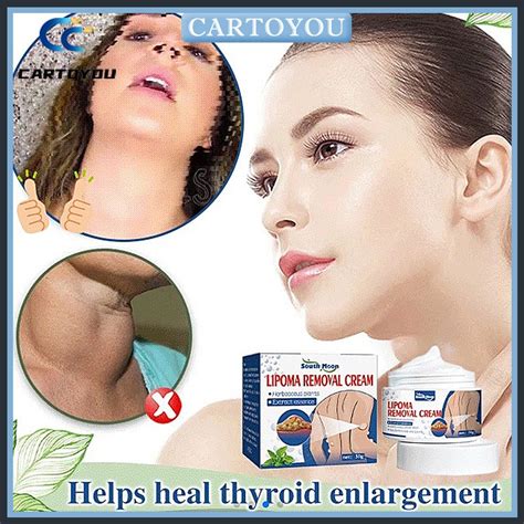 G Lipoma Removal Cream For Relieving Fat Lumps Hard Removal Lipoma