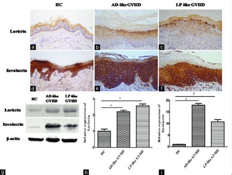 Immunohistochemical Analysis For Loricrin A C And Involucrin D F