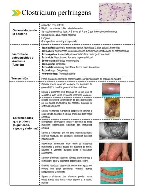 Clostridium Botulinum Clostridium Perfringens Generalidades De La